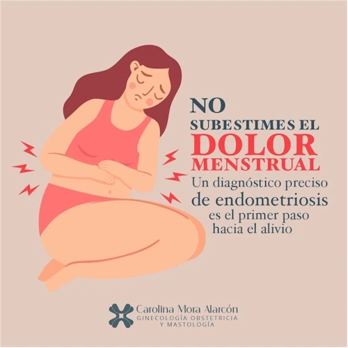Endometriosis, dolor menstrual y dolor pélvico