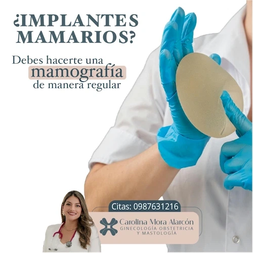 Implantes mamarios y controles de mama