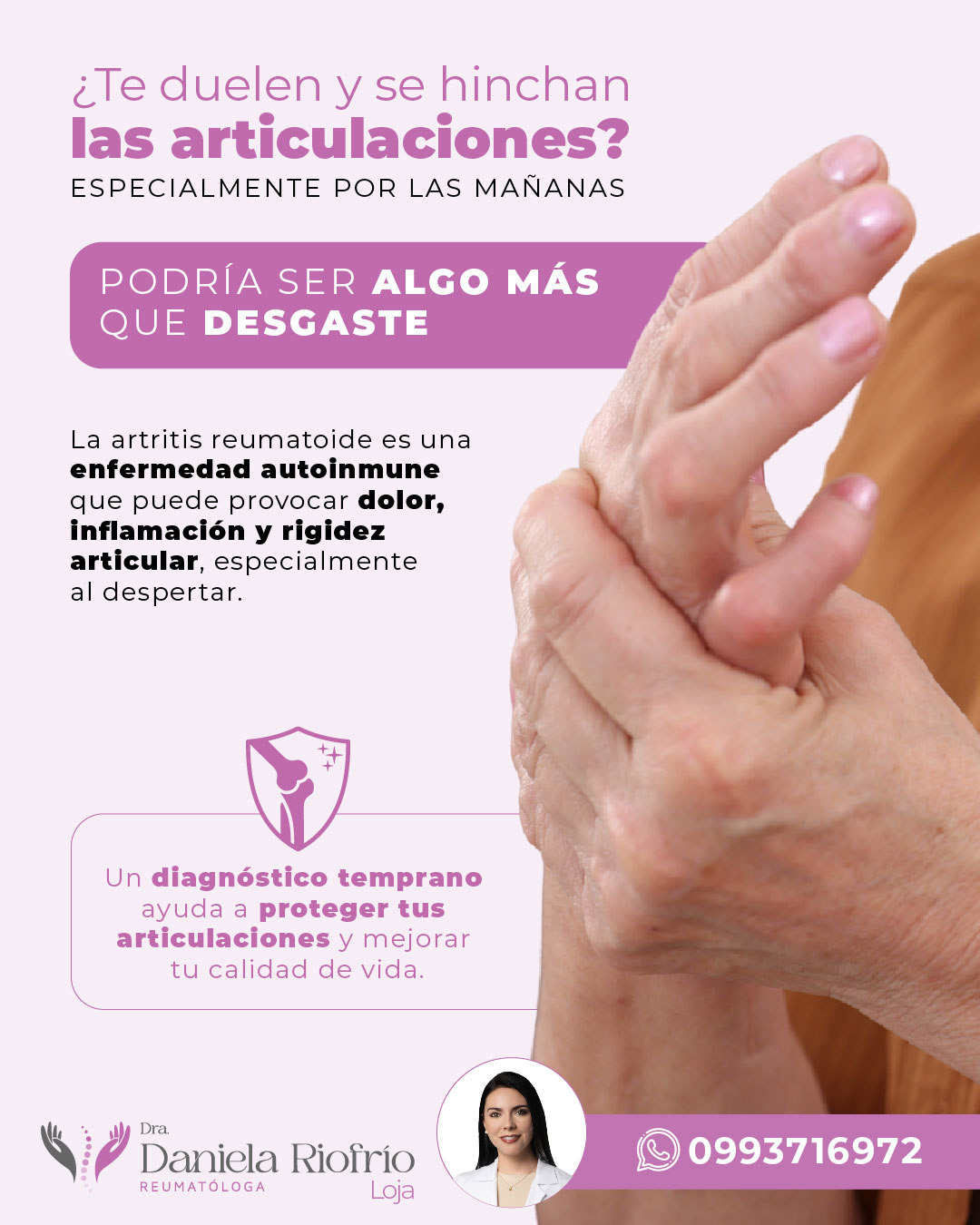 Artritis reumatoide: dolor, inflamación y rigidez persistente