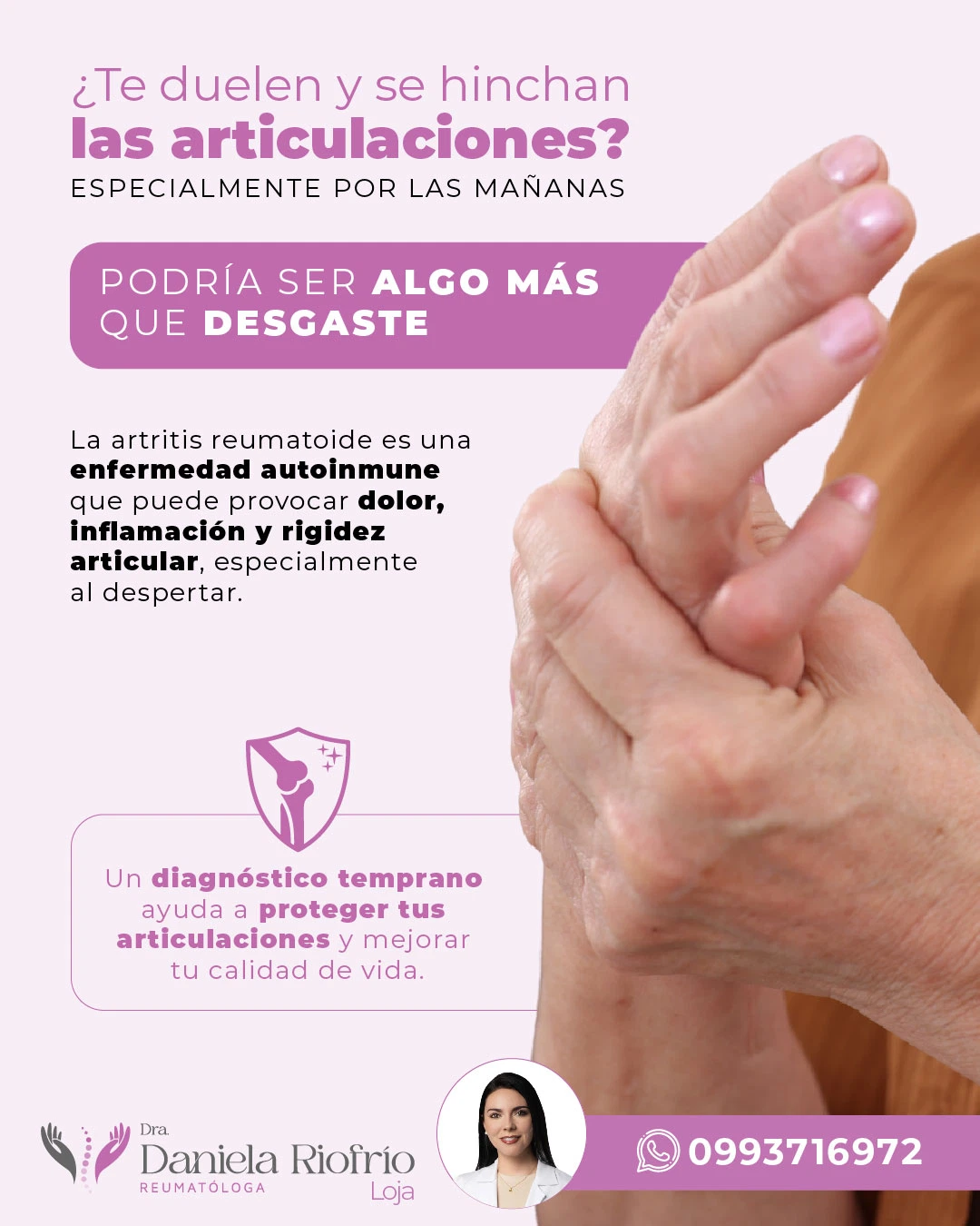 Artritis reumatoide: dolor, inflamación y rigidez persistente