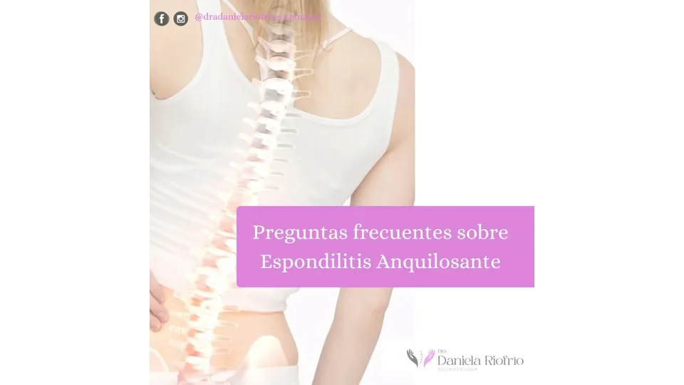 Imagen sobre Espondilitis anquilosante: preguntas frecuentes y síntomas