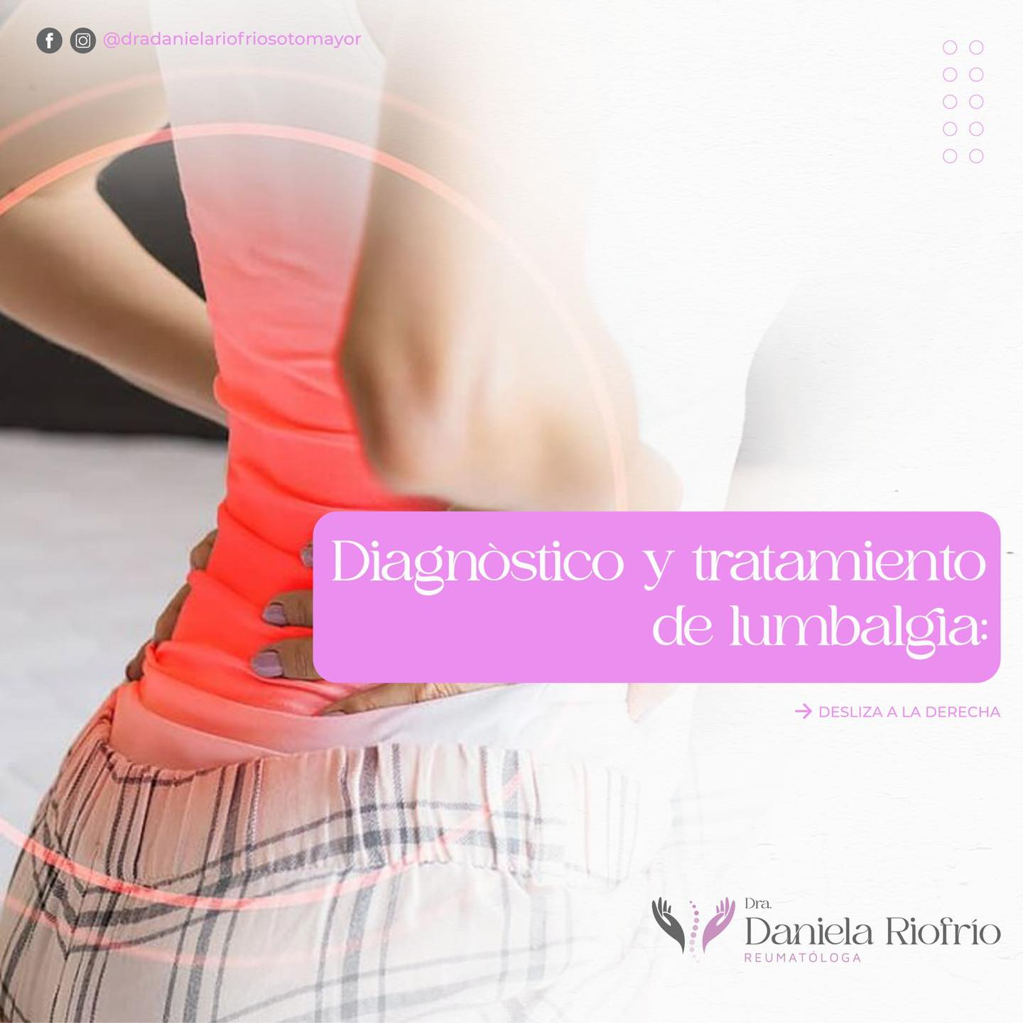 Lumbalgia: evaluación y manejo del dolor lumbar