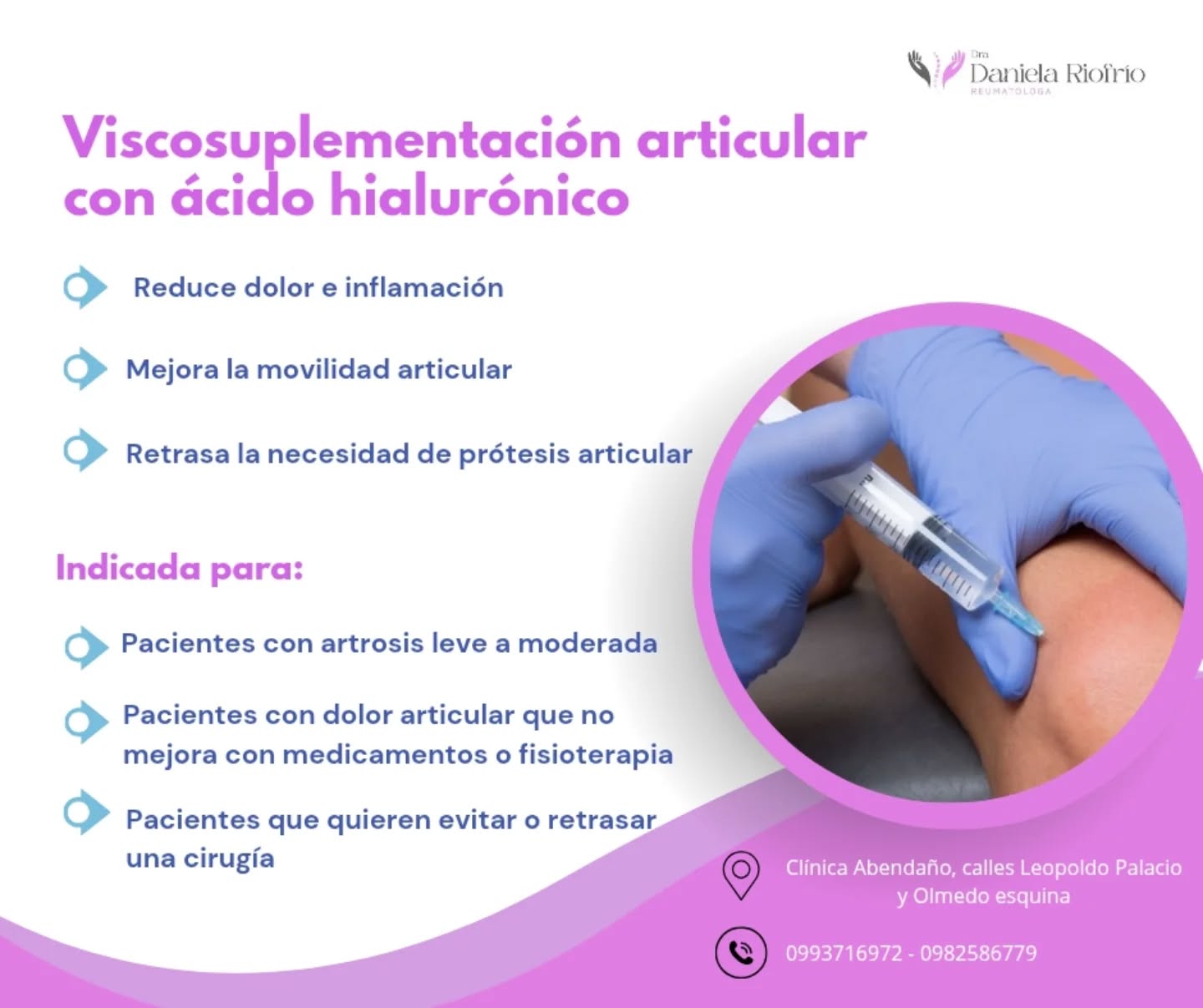 Viscosuplementación con ácido hialurónico para artrosis y dolor articular