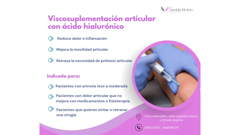 Imagen sobre Viscosuplementación con ácido hialurónico para artrosis y dolor articular