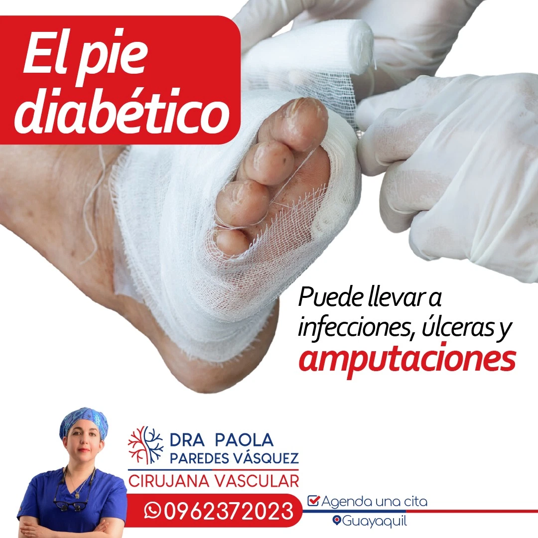 Dra. Paola Paredes Vásquez - Cirugía vascular y Flebología