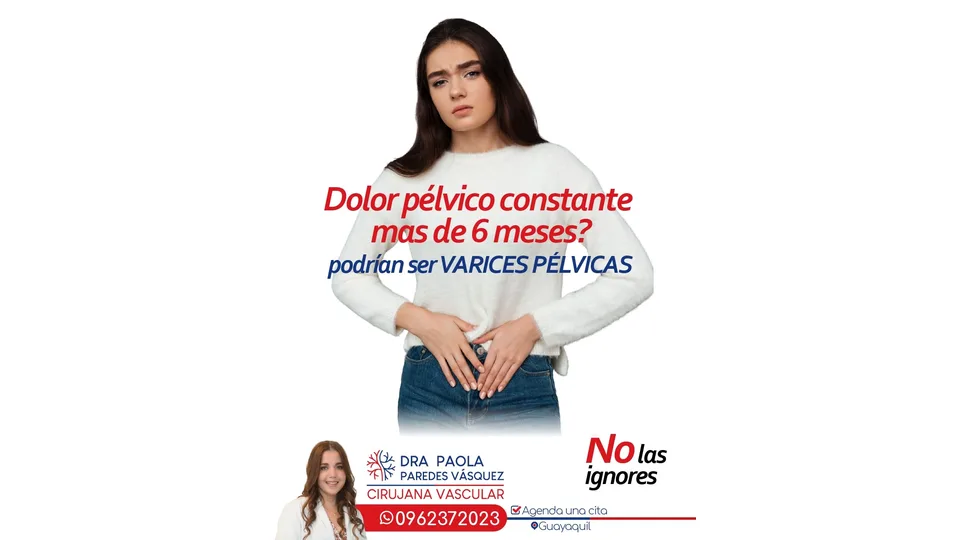 Imagen sobre Várices pélvicas y dolor pélvico persistente