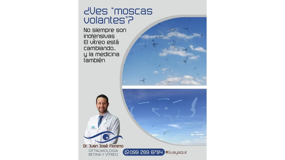 Imagen sobre Moscas volantes: cuándo deben ser evaluadas por un oftalmólogo