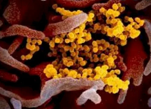 COVID 19: Una enfermedad demasiado contagiosa