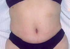 Imagen relacionada con abdomen4