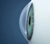 CORNEA NORMAL