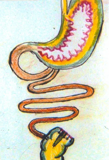 colonectomia Guayaquil