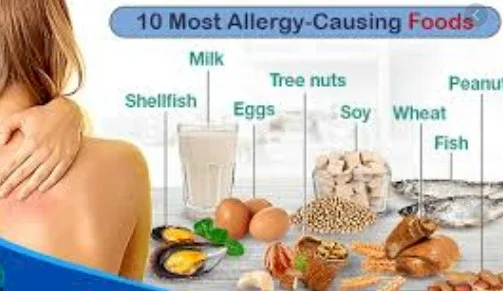Imagen del artículo Los alimentos y la alergia