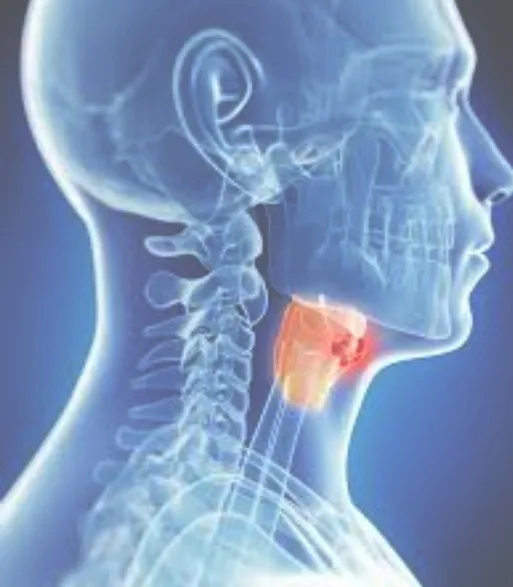 Imagen del artículo cáncer de laringe
