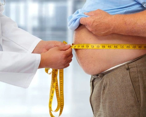 Imagen del artículo Cirugía Bariátrica - Cirugía de la Obesidad