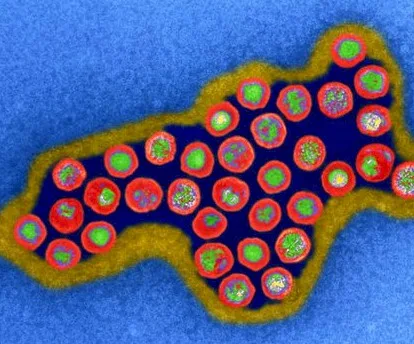 Imagen del artículo Infección por citomegalovirus en el embarazo