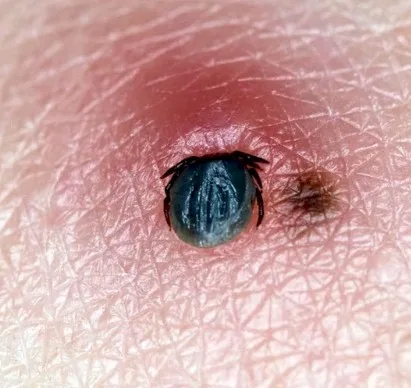 Imagen del artículo La Ehrlichiosis Humana una enfermedad infecciosa aguda que afecta a humanos y animales