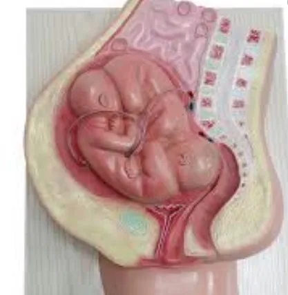 Imagen del artículo Cuáles son los riesgos del embarazo gemelar?