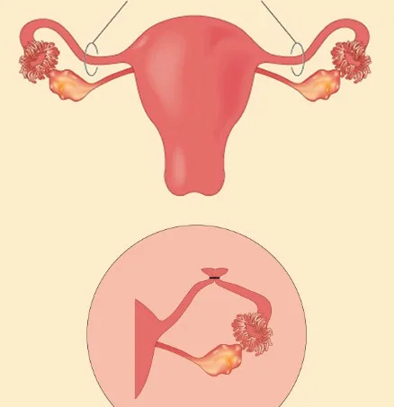 Imagen del artículo E