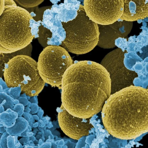 Imagen del artículo Estafilococo aureus resistente a meticilina (sarm) o "superbug"