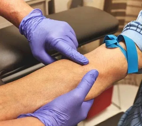 Imagen del artículo Lo que debe saber antes de realizarse un examen de laboratorio