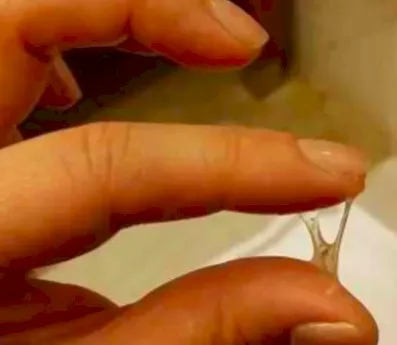 Imagen del artículo Flujo vaginal durante el embarazo
