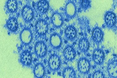 Imagen del artículo Lecciones aprendidas de la Gripe Influenza AH1 N1