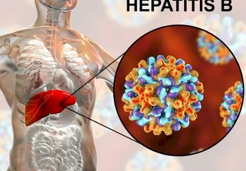 hepatitis b