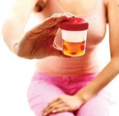 Imagen del artículo Por qué es tan frecuente la infección urinaria en la mujer ?