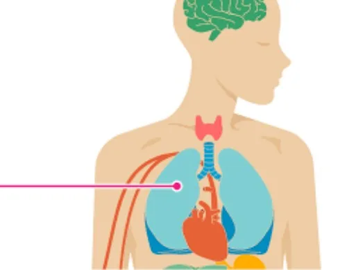 Imagen del artículo Lupus y embarazo