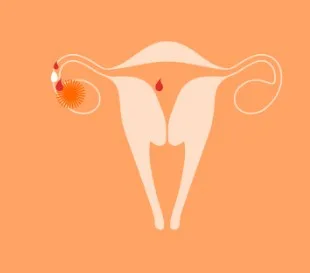 Imagen del artículo Cómo puedo saber si estoy ovulando?