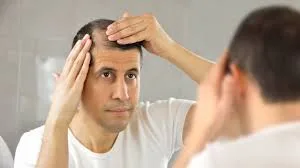 Pérdida del cabello: causas y prevención