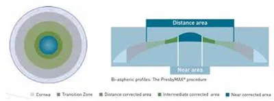 La Degeneración macular tiene control
