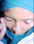 OPCIONES EN LA CIRUGIA DEL DORSO NASAL: Cirugía nasal complicada