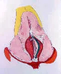 OPCIONES EN LA CIRUGIA DEL DORSO NASAL: Cirugía nasal complicada