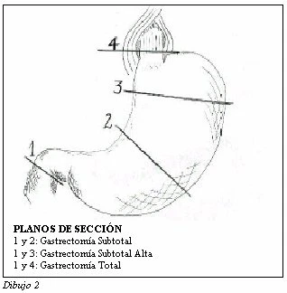 Figura: 21d