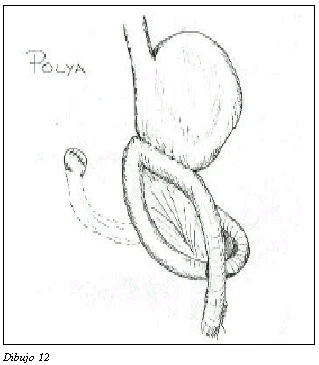 Figura: 31d