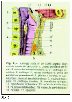 TrAquíeotomás y TrAquíeostomás