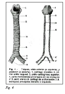 TrAquíeotomás y TrAquíeostomás