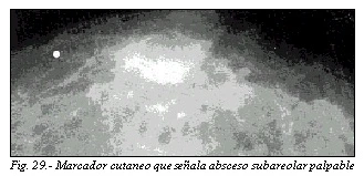 Figura: p807 2