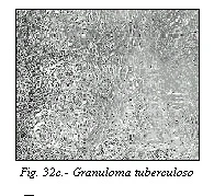 Figura: p809 2
