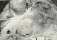 Dorello?s canal: a microanatomical study