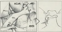 Dorello?s canal: a microanatomical study