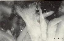 Dorello?s canal: a microanatomical study