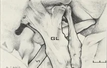 Dorello?s canal: a microanatomical study
