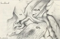 Dorello?s canal: a microanatomical study