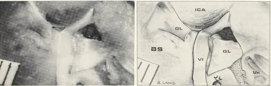 Dorello?s canal: a microanatomical study
