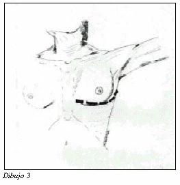 Figura: p684 2