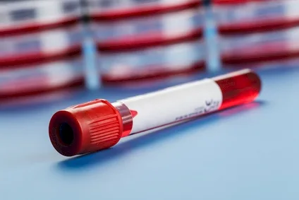 Imagen del artículo IMPORTANCIA DEL DIAGNOSTICO TEMPRANO DEL VIH (VIRUS INMUNO DEFICIENCIA HUMANA).