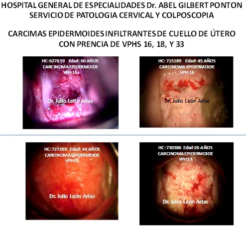 Presencia de VPH en mujeres mayores de 30 años