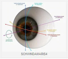 CIRUGIA LASER DE OJOS